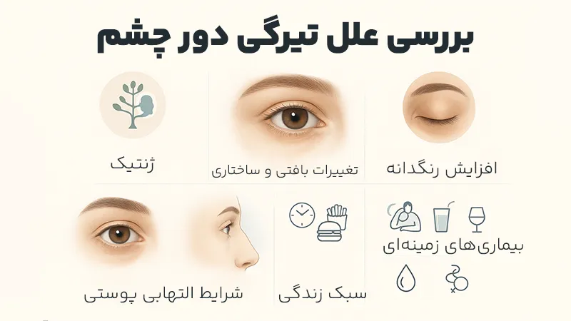 علل تیرگی دور چشم