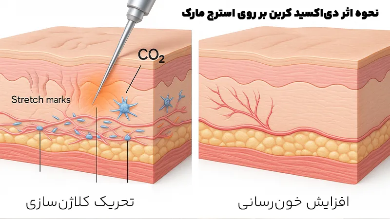 نحوه اثر دی‌اکسید کربن بر روی استرچ مارک