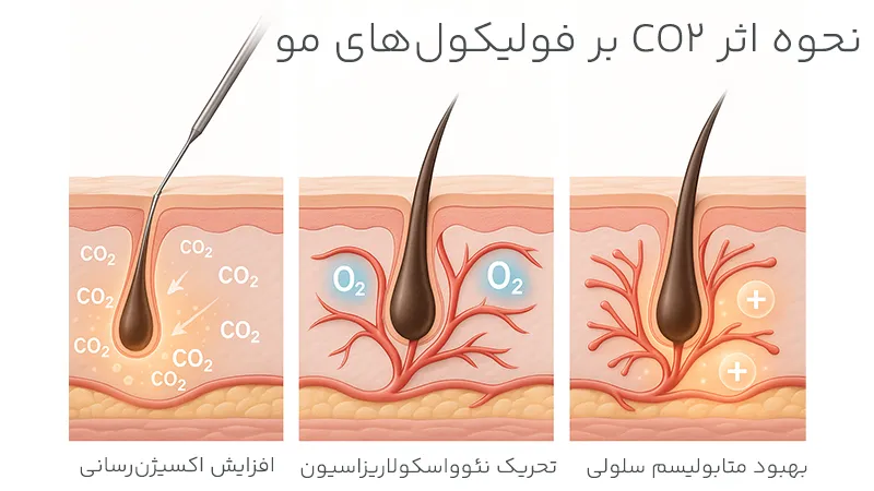 نحوه اثر CO₂ بر فولیکول‌های مو