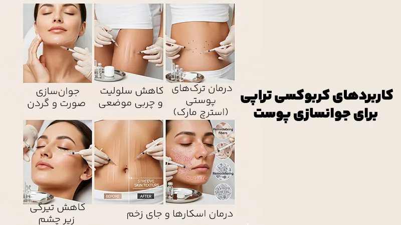 کربوکسی تراپی برای جوانسازی پوست چه کاربردهایی دارد؟