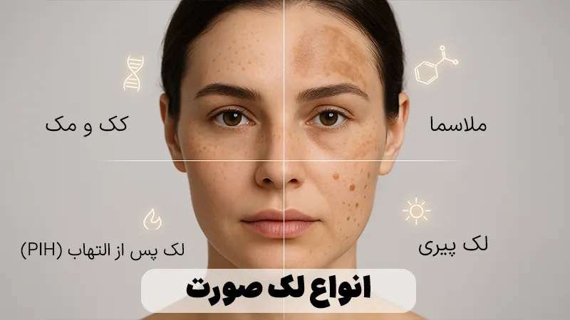انواع لک صورت