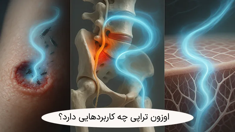 کاربردهای اوزون درمانی
