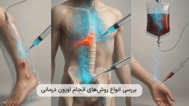 روش‌های انجام اوزون تراپی