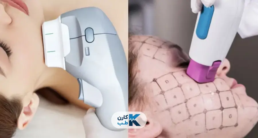 دستگاه ترماژ (Thermage)