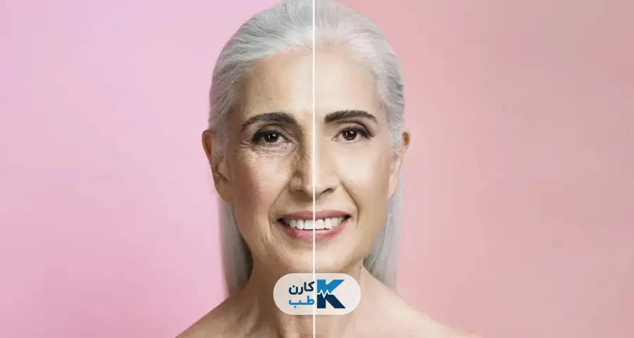 کاربرد دستگاه میکرونیدلینگ 