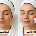 مقایسه کربوکسی‌تراپی و پلاژن‌تراپی