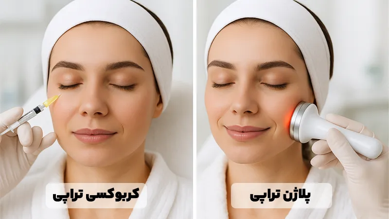 مقایسه کربوکسی‌تراپی و پلاژن‌تراپی