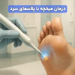 درمان میخچه با پلاسمای سرد