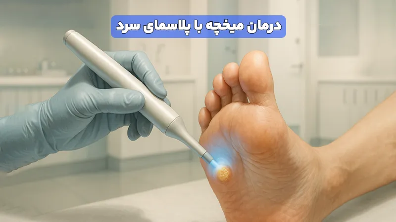 درمان میخچه با پلاسمای سرد