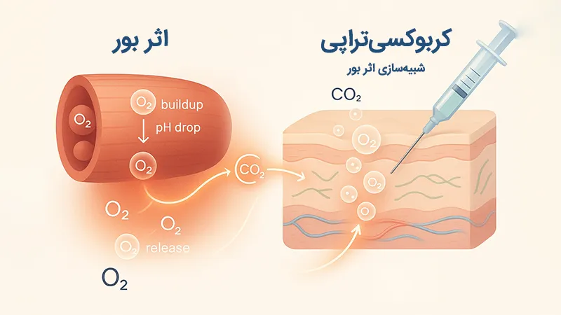 ارتباط اثر بور و کربوکسی تراپی