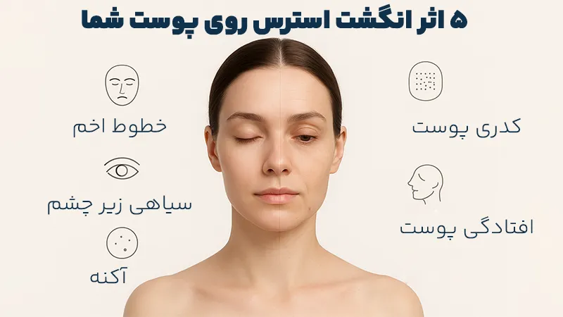 نشانه های استرس بر روی پوست