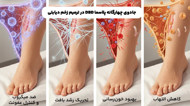 نحوه عملکرد DBD پلاسما در بهبودی زخم دیابتی