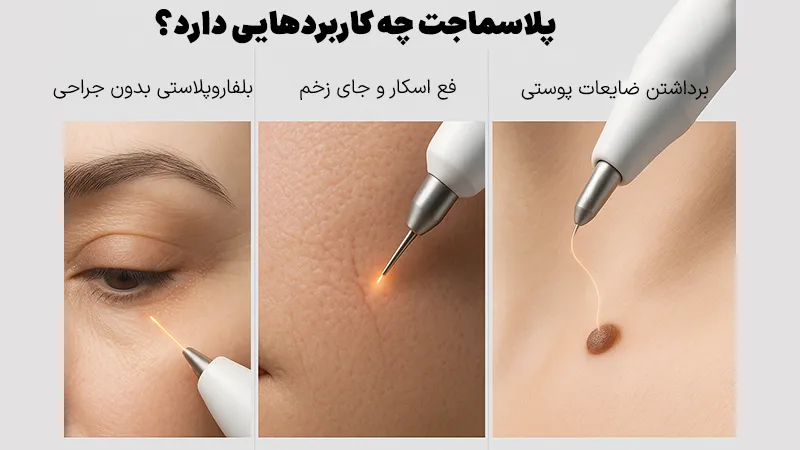 کاربردهای پلاسماجت