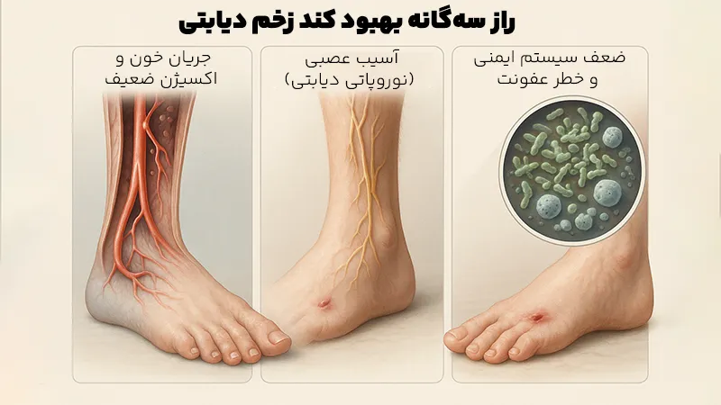 علل بهبود کند زخم دیابتی