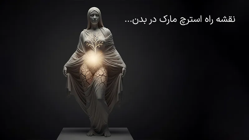 استرچ مارک در کدام قسمت های بدن ایجاد می‌شود؟