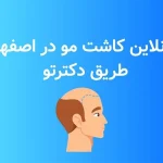 کلینیک کاشت مو در اصفهان