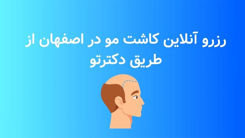 کلینیک کاشت مو در اصفهان
