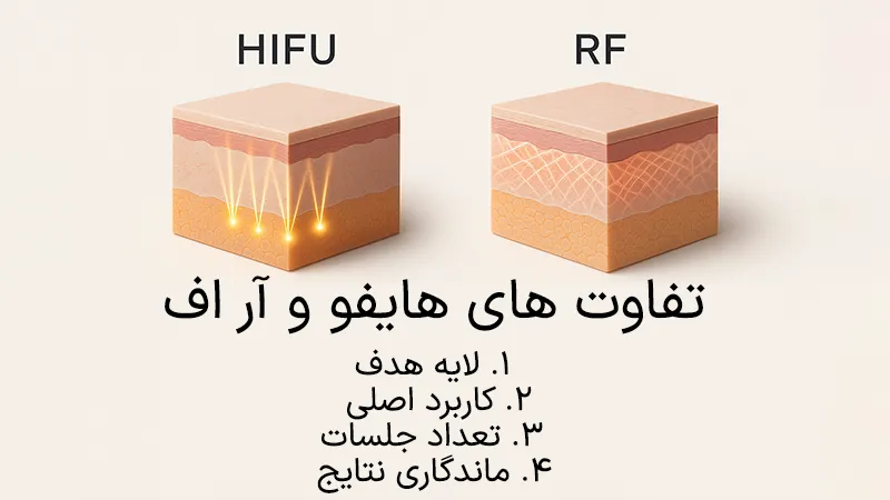 تفاوت‌های هایفو و آر اف