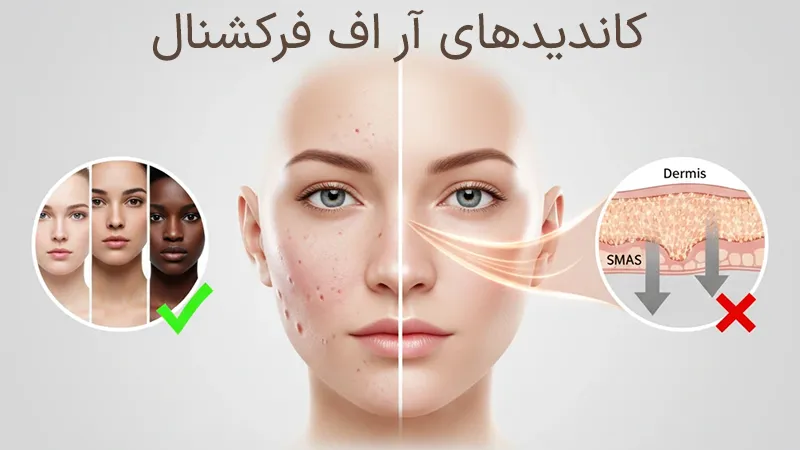 کاندیدهای آر اف فرکشنال