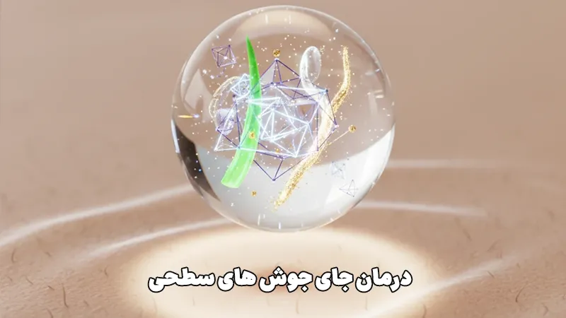 درمان جای جوش سطحی