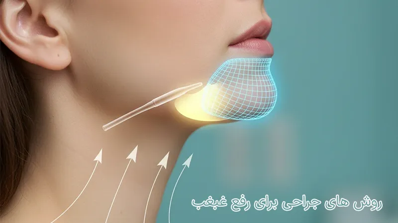 روش‌های جراحی برای از بین بردن غبغب