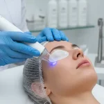 درمان منافذ باز پوست با پلاسما DBD