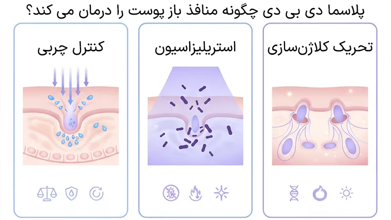 درمان منافذ باز پوست با پلاسما دی بی دی