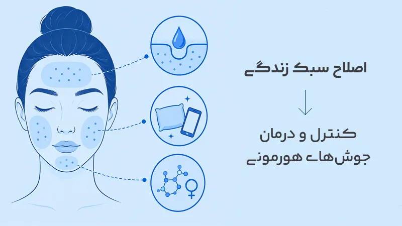 درمان جوش های هورمونی